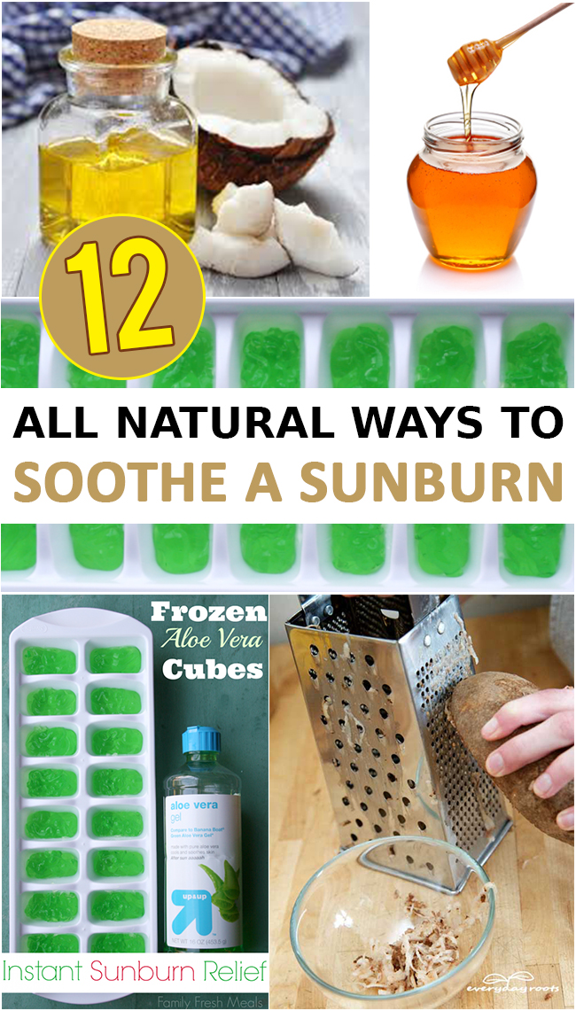 12 All Natural Ways to Soothe a Sunburn